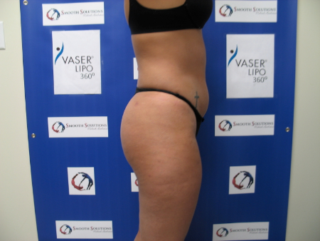 After Image: Patient # 54169 - 