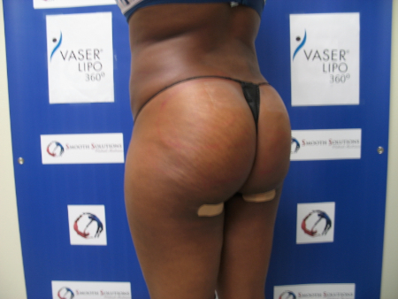After Image: Patient # 23694 - 