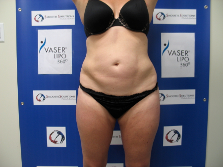 After Image: Patient # 38652 - 