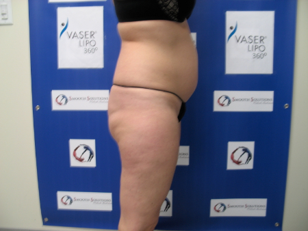 Before Image: Patient # 17028 - 