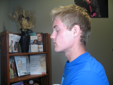After Image: Patient # 22454 - 