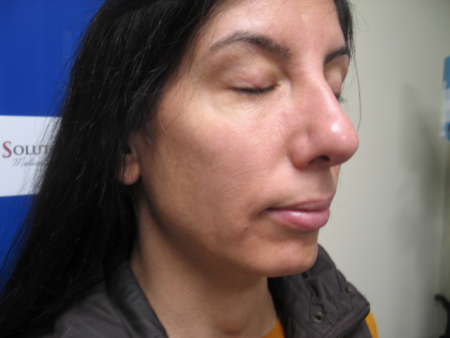 After Image: Patient # 40495 - 