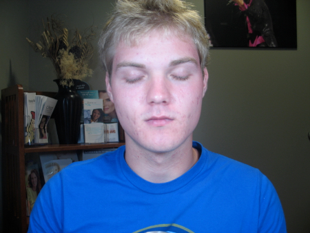After Image: Patient # 22454 - 