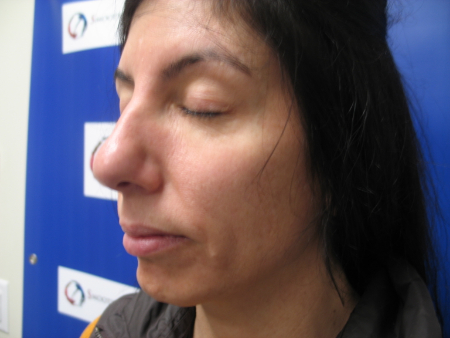 After Image: Patient # 40495 - 