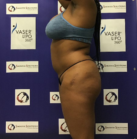 Before Image: Patient # 48526 - 