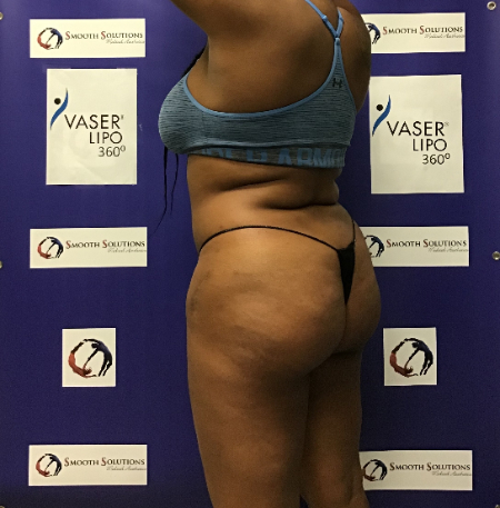 Before Image: Patient # 48526 - 