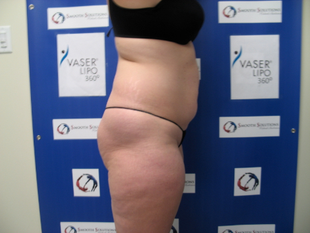Before Image: Patient # 97884 - 
