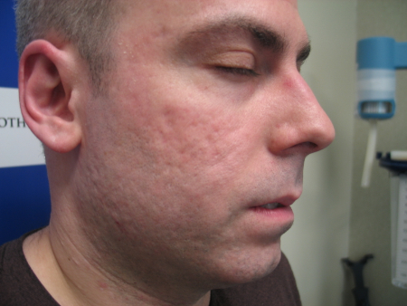 After Image: Patient # 31166 - 