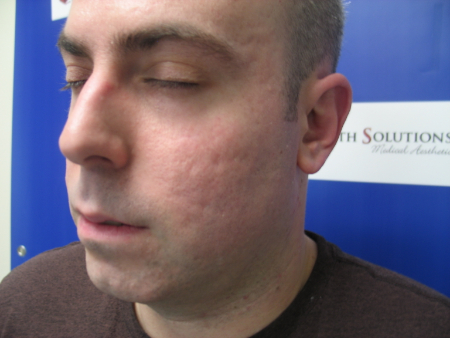 Before Image: Patient # 31166 - 