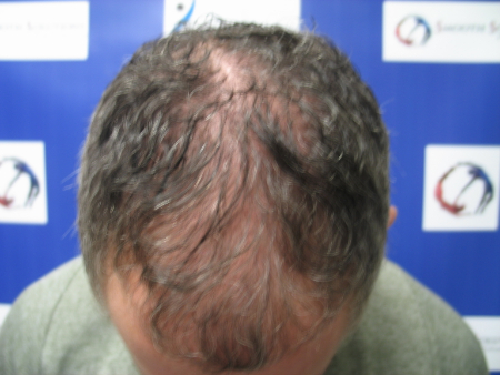 Before Image: Patient # 68433 - 