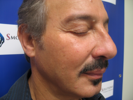After Image: Patient # 18077 - 