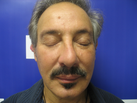 After Image: Patient # 18077 - 