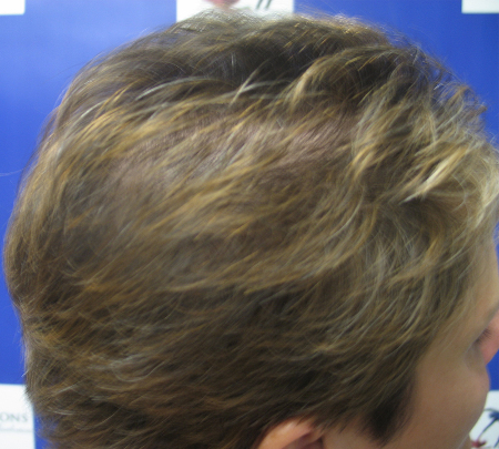After Image: Patient # 84645 - 