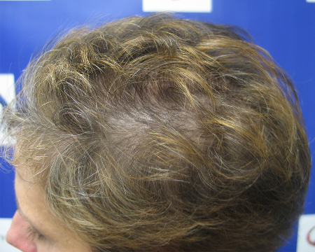 After Image: Patient # 84645 - 