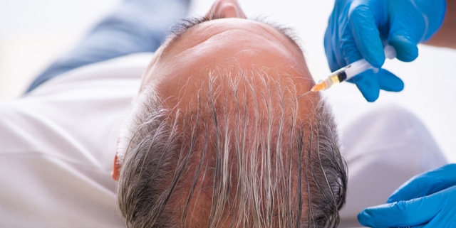 Old man visiting young male doctor in hair transplantation 640x321 1