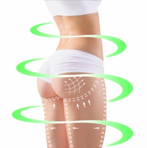 Brazilian Butt Lift Williamsville NY