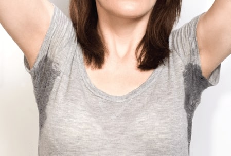 Hyperhidrosis Treatment Williamsville NY