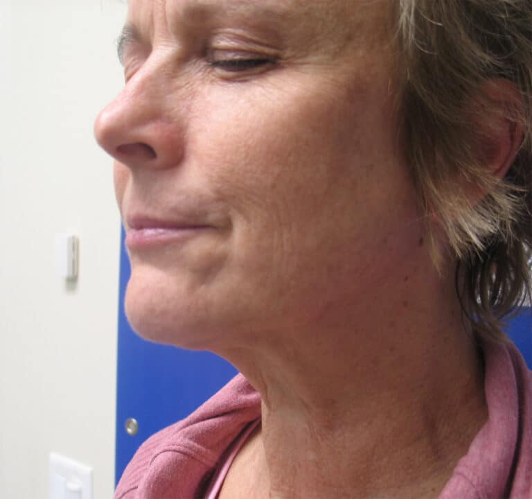 After Image: Sylfirm - left-front-oblique