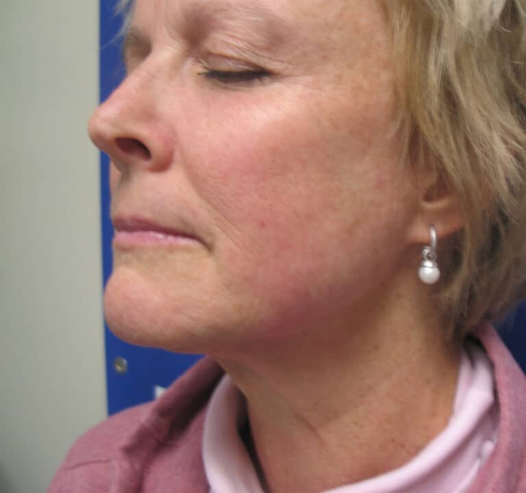 Before Image: Sylfirm - left-front-oblique