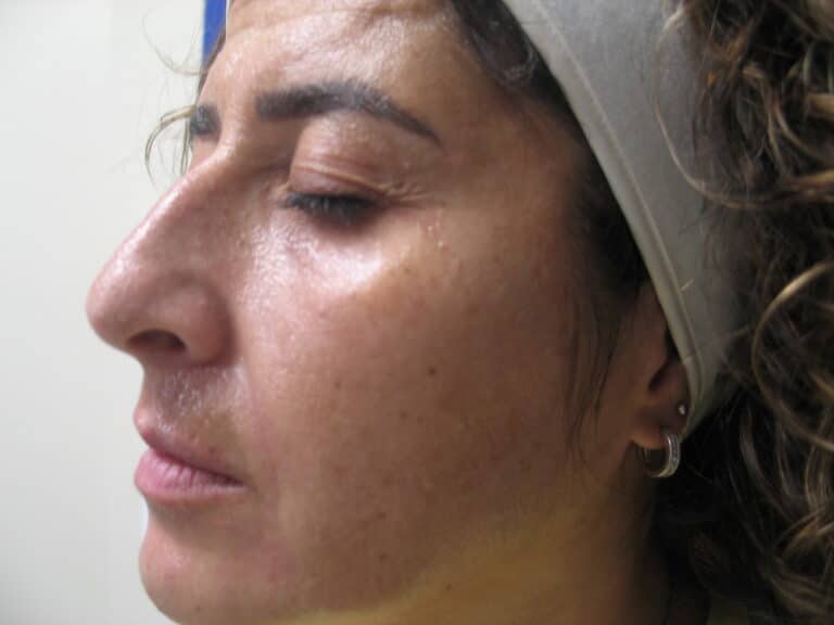 After Image: Sylfirm - left-front-oblique