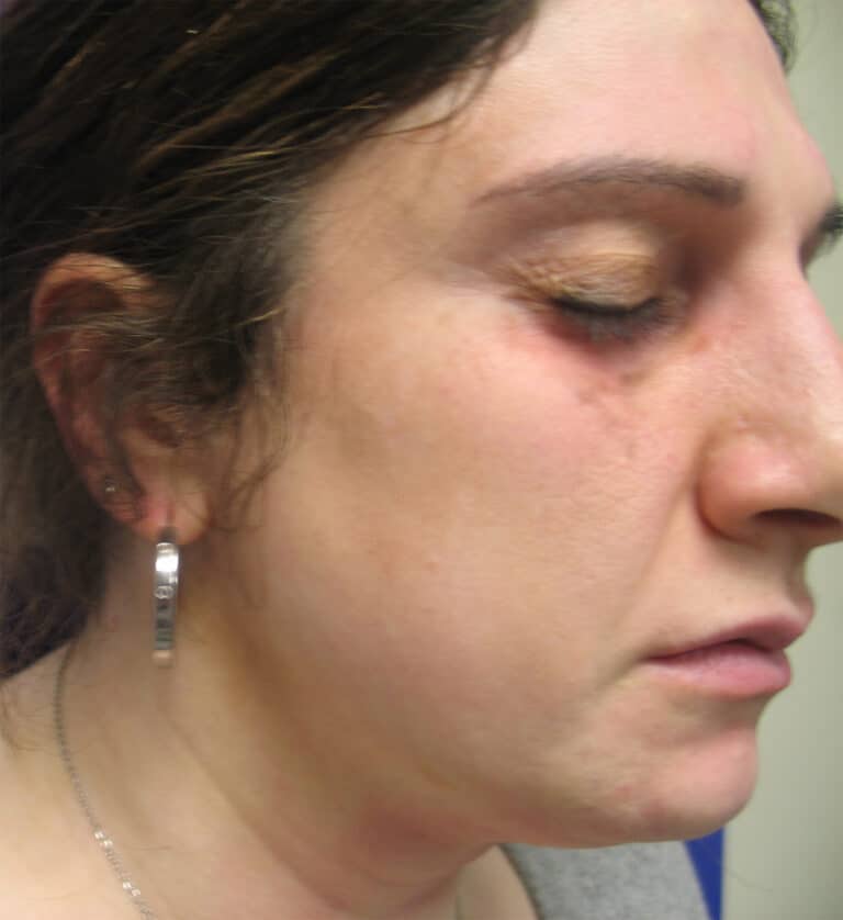 After Image: Sylfirm - right-front-oblique