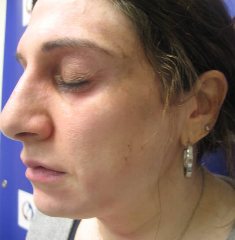 After Image: Sylfirm - left-side