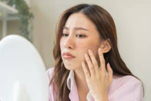 Woman looking in the mirror unhappy with sun spots on her skin, considering CryoClear treatment