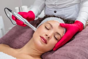 Woman with glowing skin undergoing microneedling treatment in Williamsville, NY