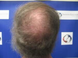 After Image: Patient # 5191