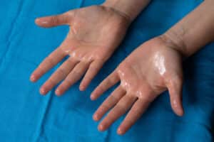 Woman holding hands around her midsection indicating a healthy gut Person with sweaty hands due to hyperhidrosis