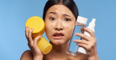 asian woman holding cream jars for acne problems
